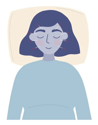 acupuncture during pregnancy acupuncture during pregnancy