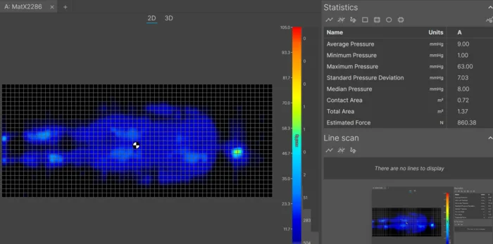 The pressure map readings for an average-weight back sleeper on the Aurora Luxe mattress.